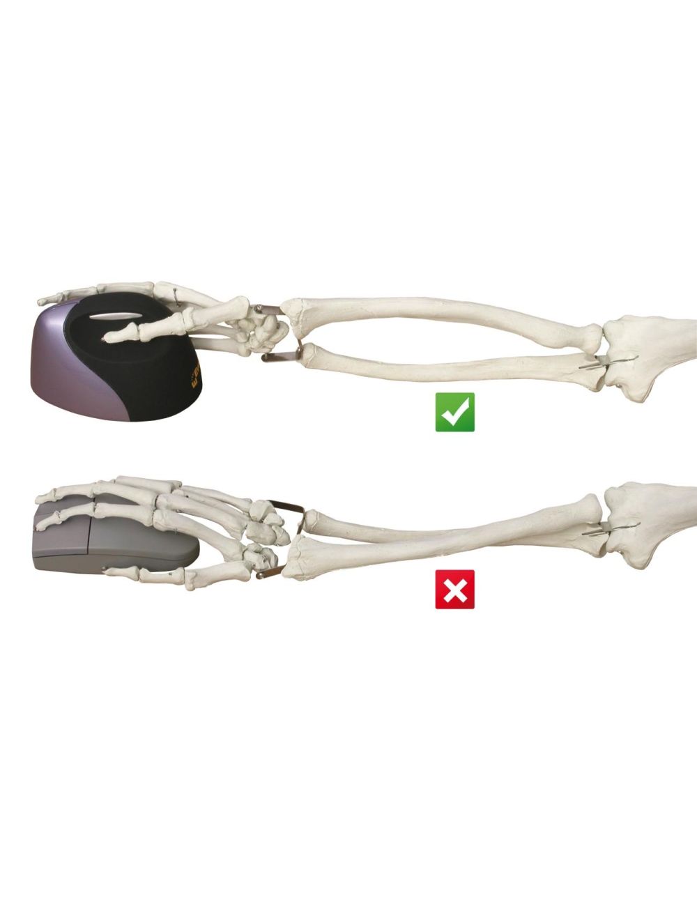 Evoluent VerticalMouse 4 Derecho Inalámbrico