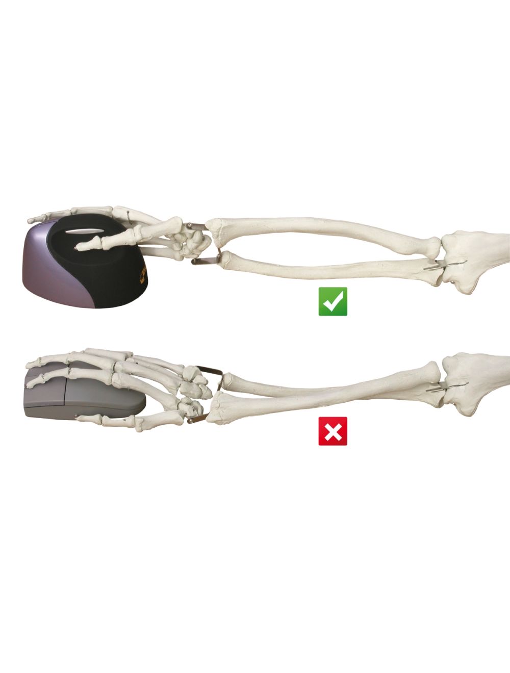Evoluent VerticalMouse 4 Derecho